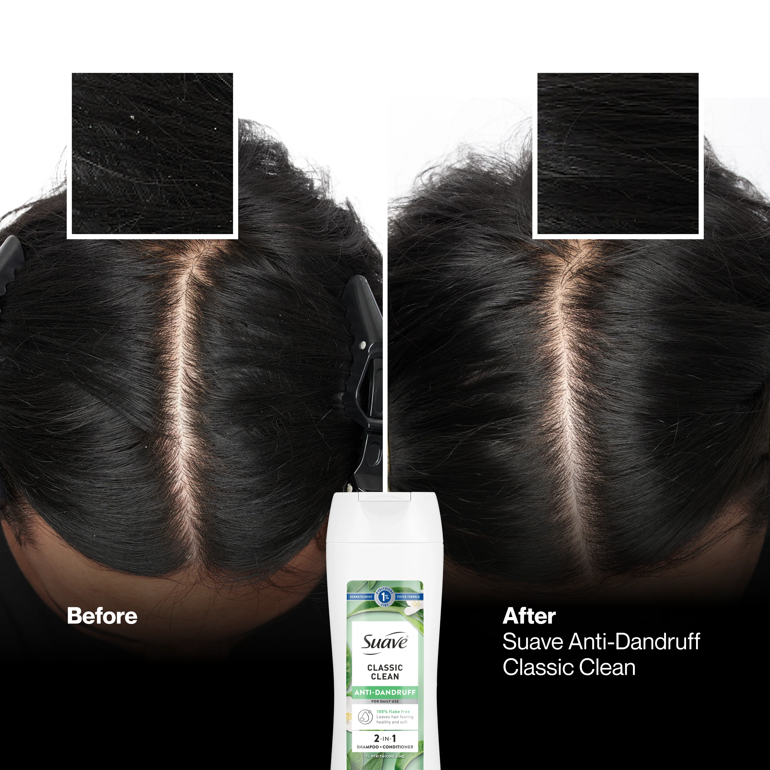 Classic Clean Anti Dandruff 2-in-1 Shampoo & Conditioner - Image 4